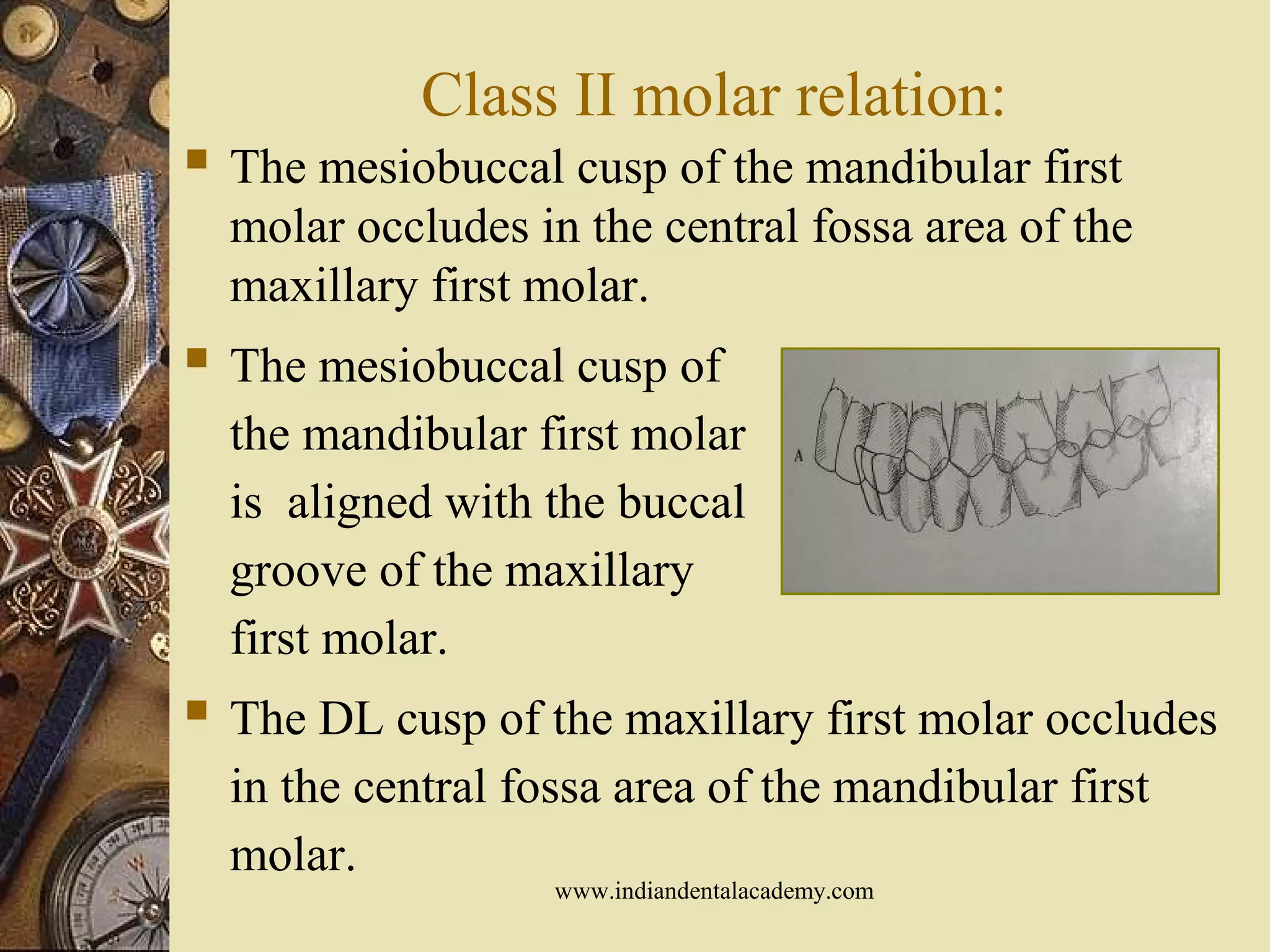 Class II molar relation:
 The mesiobuccal cusp of the mandibular first
molar occludes in the central fossa area of the
maxillary first molar.
 The mesiobuccal cusp of
the mandibular first molar
is aligned with the buccal
groove of the maxillary
first molar.
 The DL cusp of the maxillary first molar occludes
in the central fossa area of the mandibular first
molar.
www.indiandentalacademy.com
 