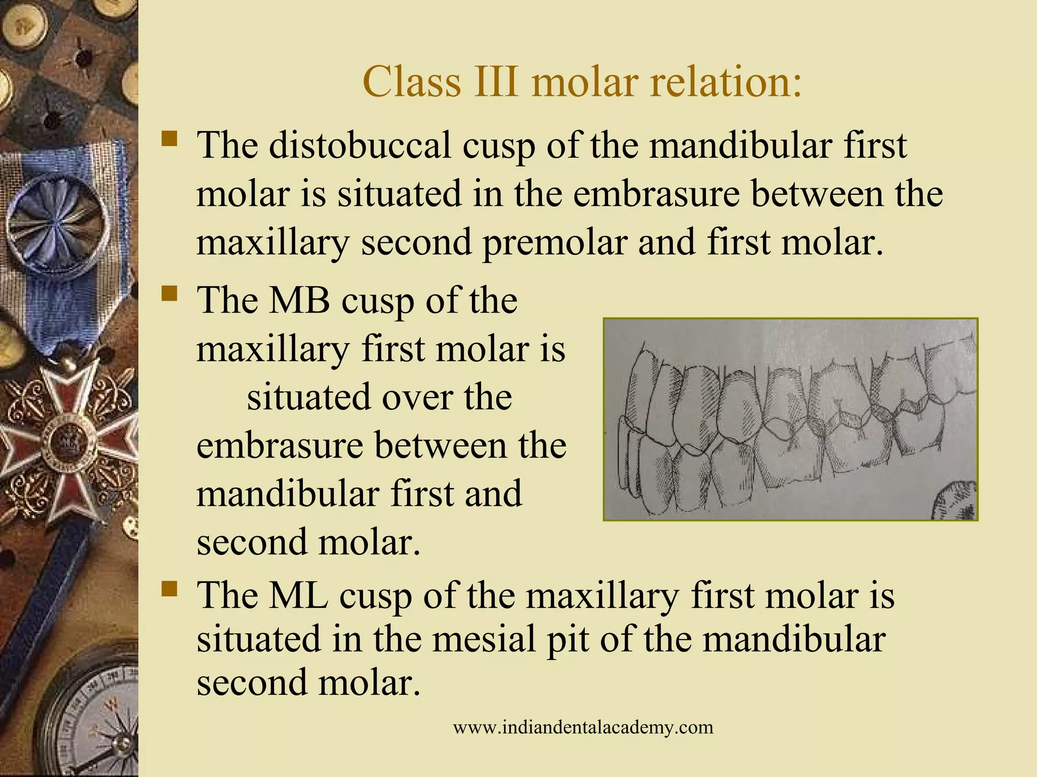 Class III molar relation:
 The distobuccal cusp of the mandibular first
molar is situated in the embrasure between the
maxillary second premolar and first molar.
 The MB cusp of the
maxillary first molar is
situated over the
embrasure between the
mandibular first and
second molar.
 The ML cusp of the maxillary first molar is
situated in the mesial pit of the mandibular
second molar.
www.indiandentalacademy.com
 