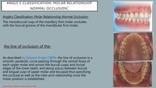 Classification_of_malocclusion[1] [Read-Only].pptx