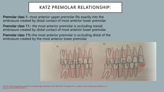 Classification_of_malocclusion[1] [Read-Only].pptx