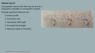 Classification_of_malocclusion[1] [Read-Only].pptx