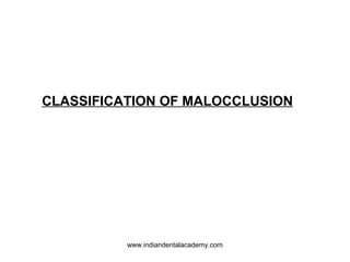 CLASSIFICATION OF MALOCCLUSION
www.indiandentalacademy.com
 