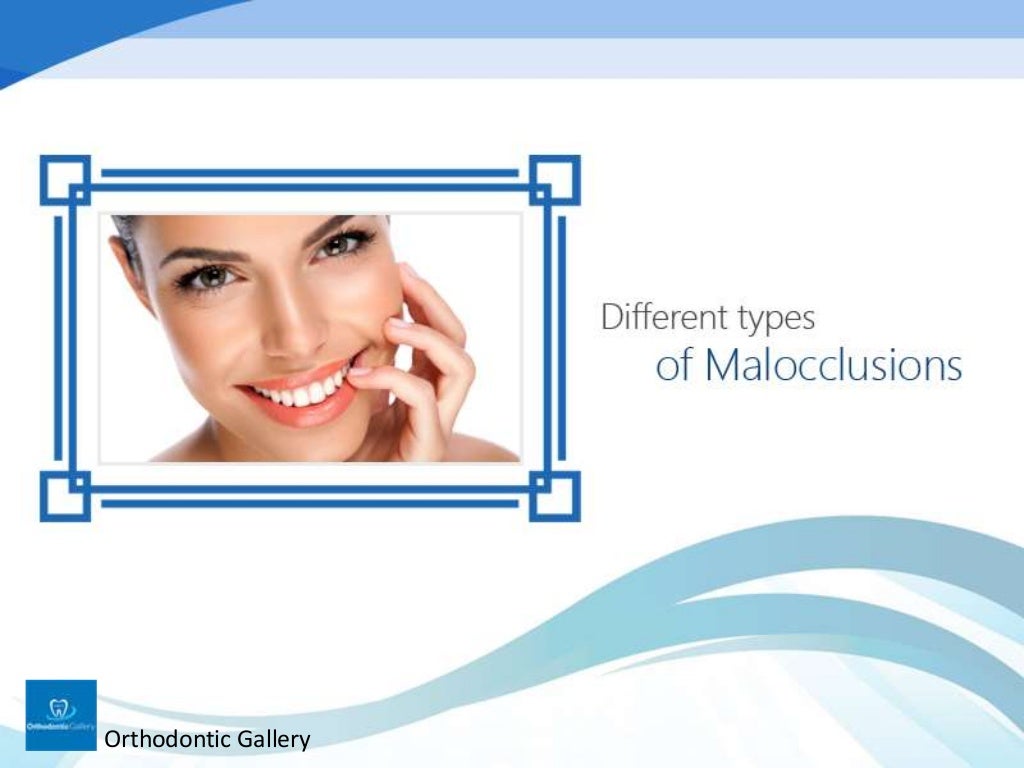 Classification of Malocclusion in Orthodontics