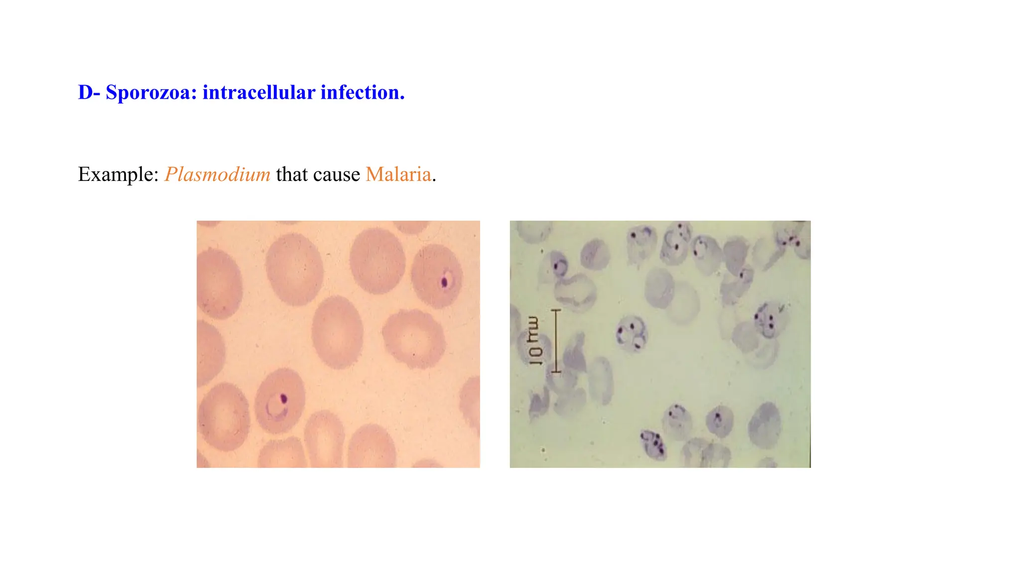 D- Sporozoa: intracellular infection.
Example: Plasmodium that cause Malaria.
 