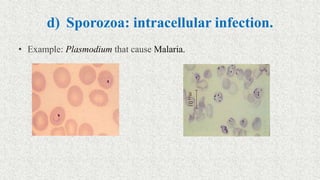 d) Sporozoa: intracellular infection.
• Example: Plasmodium that cause Malaria.
 