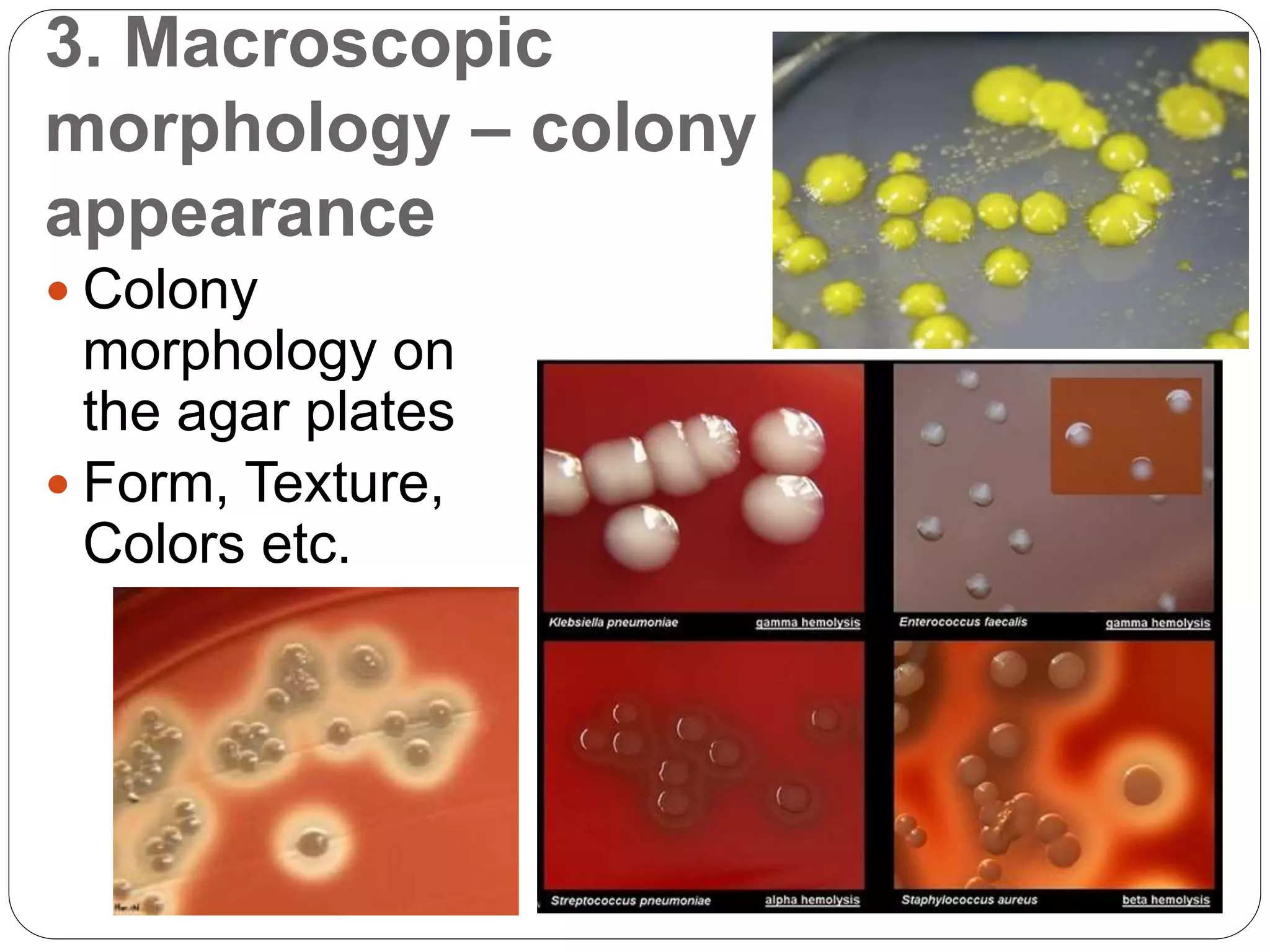 3. Macroscopic
morphology – colony
appearance
 Colony
morphology on
the agar plates
 Form, Texture,
Colors etc.
 