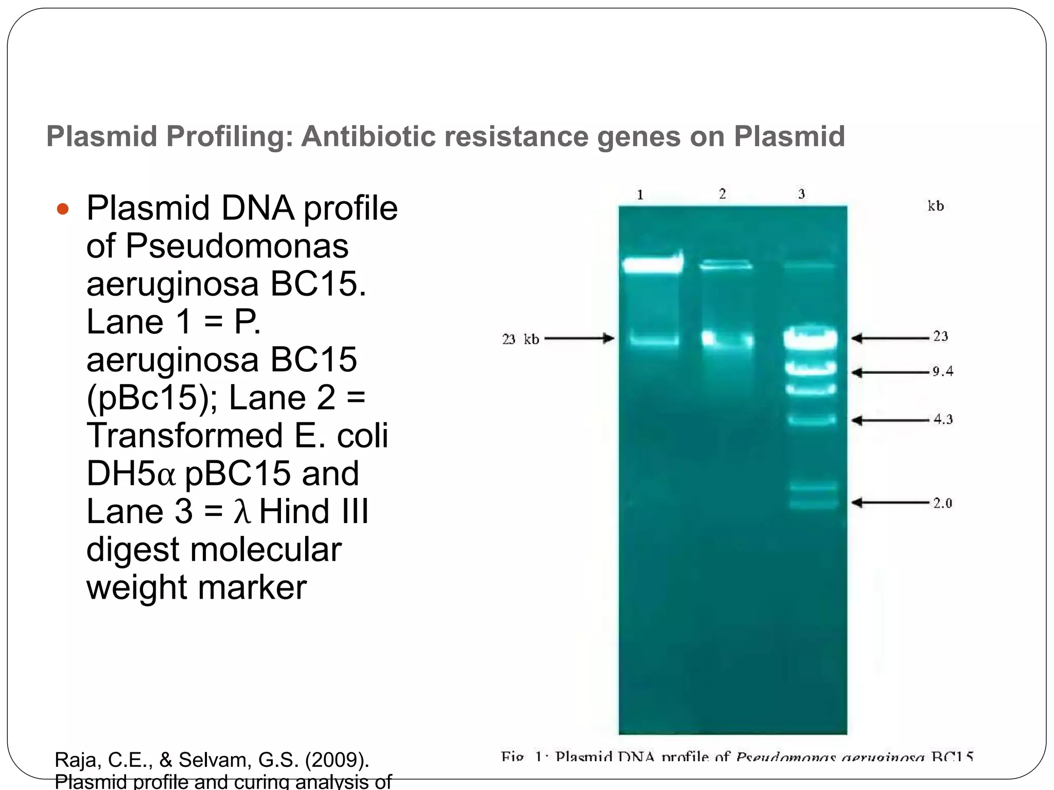 Plasmid Profiling: Antibiotic resistance genes on Plasmid
 Plasmid DNA profile
of Pseudomonas
aeruginosa BC15.
Lane 1 = P.
aeruginosa BC15
(pBc15); Lane 2 =
Transformed E. coli
DH5α pBC15 and
Lane 3 = λ Hind III
digest molecular
weight marker
Raja, C.E., & Selvam, G.S. (2009).
Plasmid profile and curing analysis of
 
