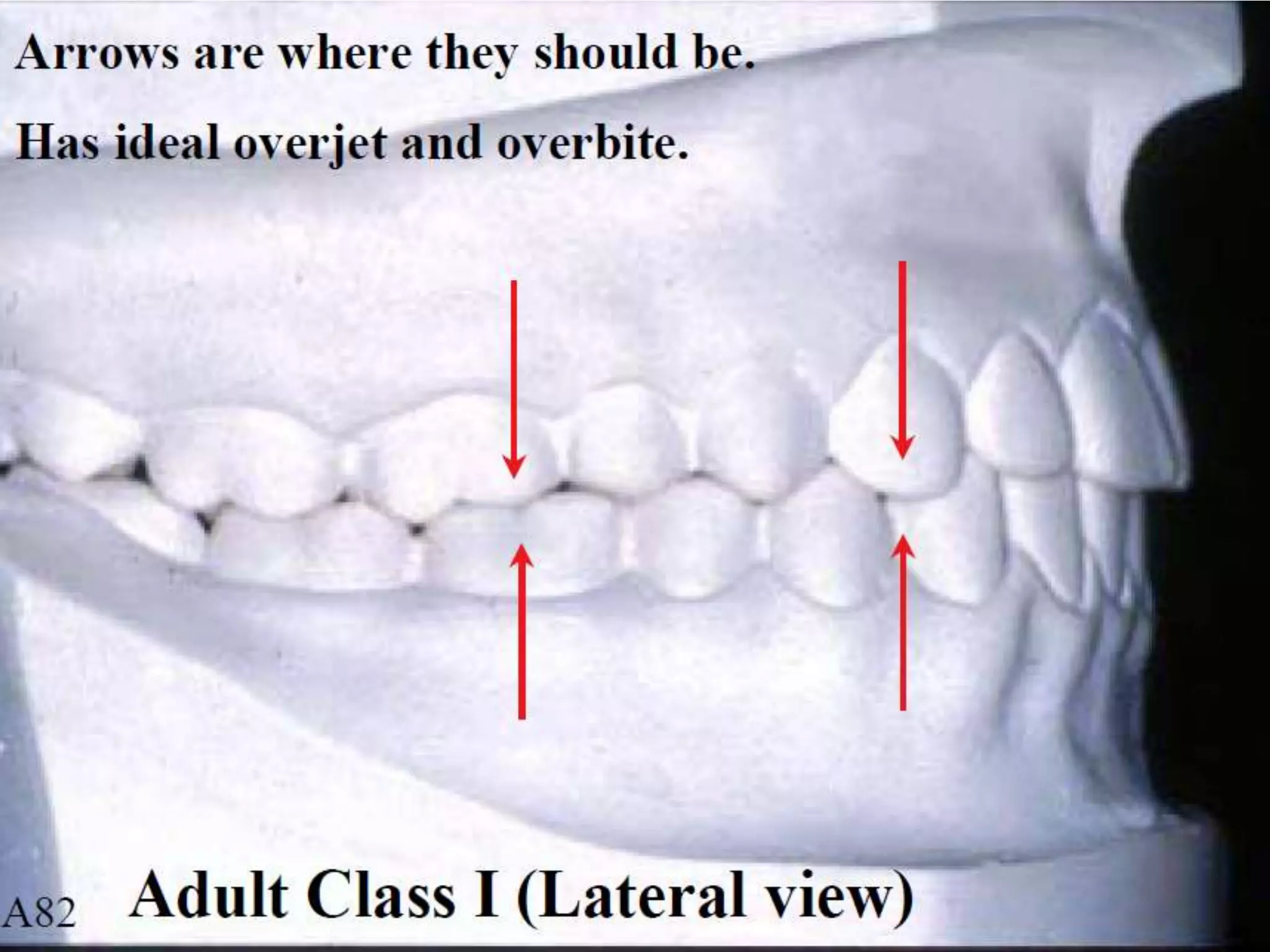 Classification of Occlusion and Malocclusion Dr. Nabil Al-Zubair | PDF