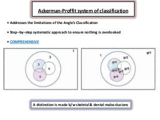 Classification of Occlusion and Malocclusion Dr. Nabil Al-Zubair | PDF