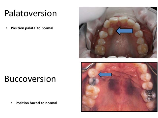 Classification of Occlusion and Malocclusion Dr. Nabil Al-Zubair