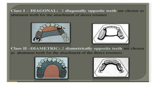 Classification of Partially Edentulous Teeth