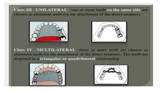 Classification of Partially Edentulous Teeth