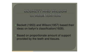 Classification of Partially Edentulous Teeth