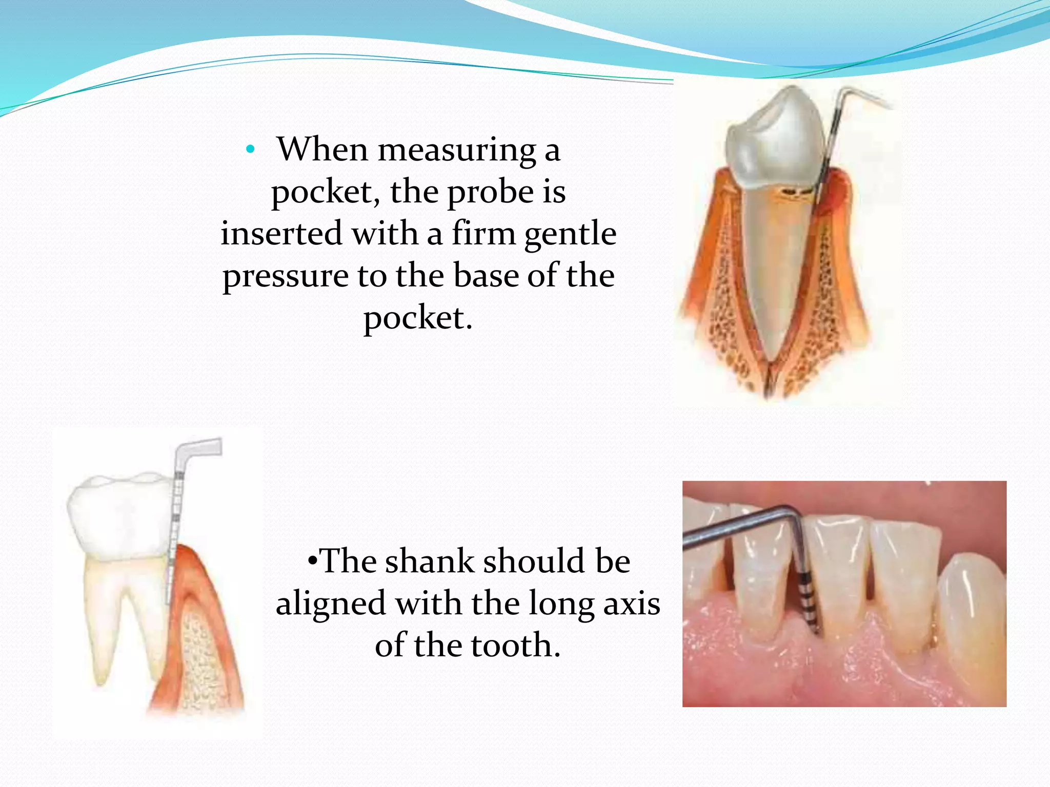 Classification of periodontal instruments PPT