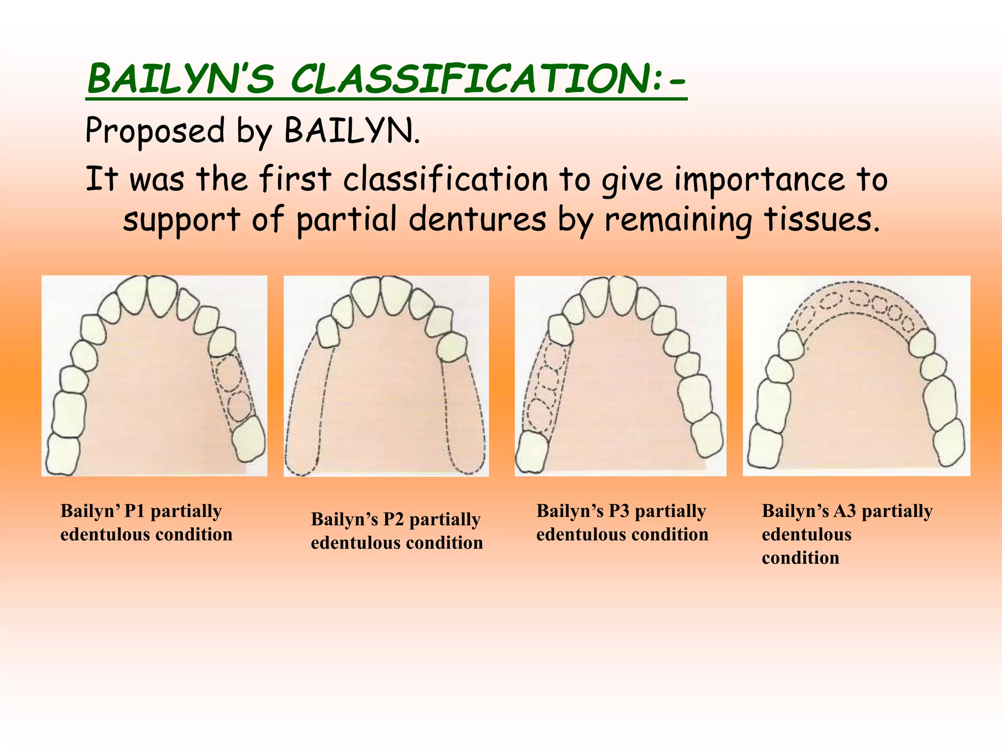 Edentulous Class Rpd CLASSIFICATION OF RPD.ppt