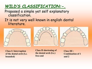 WILD’S CLASSIFICATION:-.
Proposed a simple yet self explanatory
classification.
It is not very well known in english dental
literature.
Class I: Interruption
of the dental arch (I.e.
bounded)
Class II shortening of
the dental arch (I.e.)
free-end
Class III :
Combination of 1
and 2
 