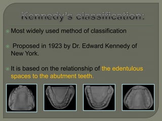 Requirements of a ClassificationAllow visualization of type of partially edentulous arches that is being considered.Allow differentiation between tooth supported and tooth-tissue supported partial dentures.Serve as a guide to the type of design to be used.Be universally accepted.