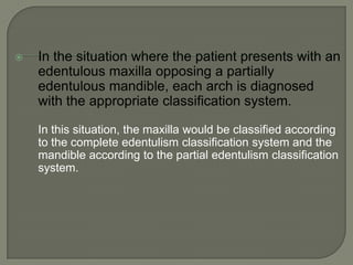 Class II—Criteria 4Residual ridgeResidual ridge morphology is the Class I complete edentulismdescription.