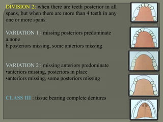 other with two available teeth separated by a distance of less than three teeth.Neurohr’s classification:Proposed in 1939, this classification is also based on the support derived. It is not commonly used due to its complexity. Many of his denture designs did not match his principles of classification.