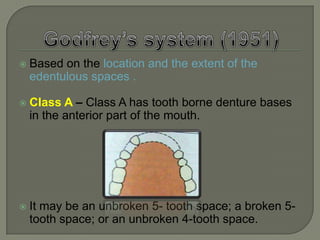  more than 4 teeth(which include a canine) in one or more spans. Class II is further subdivided into divisions with variation under each.DIVISION 1: When there are no teeth posterior to 1 or more span.VARIATION1 : Missing posteriors predominateposteriors missing, anteriors in placeposteriors missing, some anteriors missing VARIATION 2 : missing anteriors predominatenoneanteriors missing, some posteriors missing