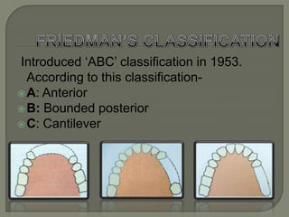 Mauk’s systembased on number, length and position of the spaces and number and position of the remaining teeth.Class I – Bilateral posterior spaces and teeth remaining in a segment in the anterior region.Class II – Bilateral posterior spaces and one or more teeth at the posterior end of one space.