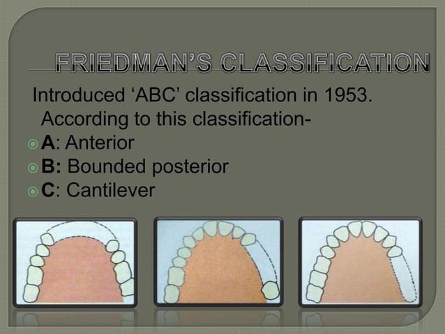 Dental Rp Classification Classification of rpd | PPTX | Dental Health | Diseases and Conditions