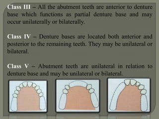 Class III : BOUNDED SADDLE. Abutment teeth not so qualified to support the denture as described in class I.Wilson in 1957 elaborated the classification as follows:Mandibularkennedy’s class III should be treated as class I