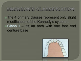 Maxillary kennedy’s class III should be treated as class I or IIICRADDOCK’S CLASSIFICATION In 1954. Class I – saddle supported on both sides by substantial abutment teeth.Class II – vertical biting forces applied to denture resisted entirely by soft tissue.Class III– tooth supported at only 1 end of the saddle. 