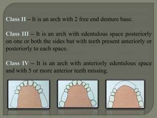 AUSTIN AND LIDGE CLASSIFICATIONIn 1957.Describes the position of teeth.Class A: missing anteriors.A1 : Missing anteriors on one side.A2 : Missing anteriors on both sides.A B1: Missing anteriors with bilateral.      		    construction.