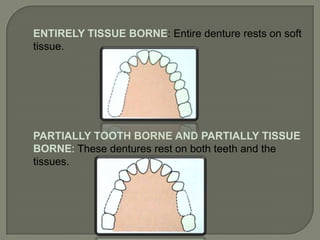 Class I – Abutment teeth are located both anterior and posterior to the denture bases, spaces may be unilateral or bilateral.Class II –All teeth areposterior to the denture base, which function as partial denture unit. It may be unilateral or bilateral.