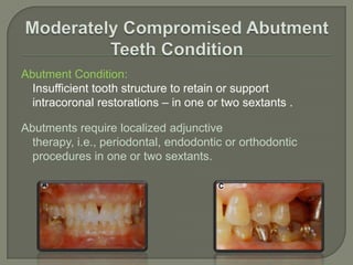 Prosthodontic diagnostic index	The American College of Prosthodontists (ACP) has developed a classification system for partial edentulism based on diagnostic findings.                                                             J Prosthodont 2002;11:181-193.