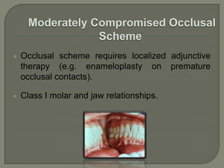 Any anterior maxillary span that does not exceed 2 missing incisors