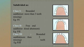 Craddock Classification Rpd CLASSIFICATION OF RPD & APPLEGATES RdentureLE.pptx