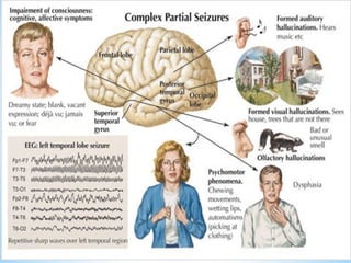 Classification of seizures