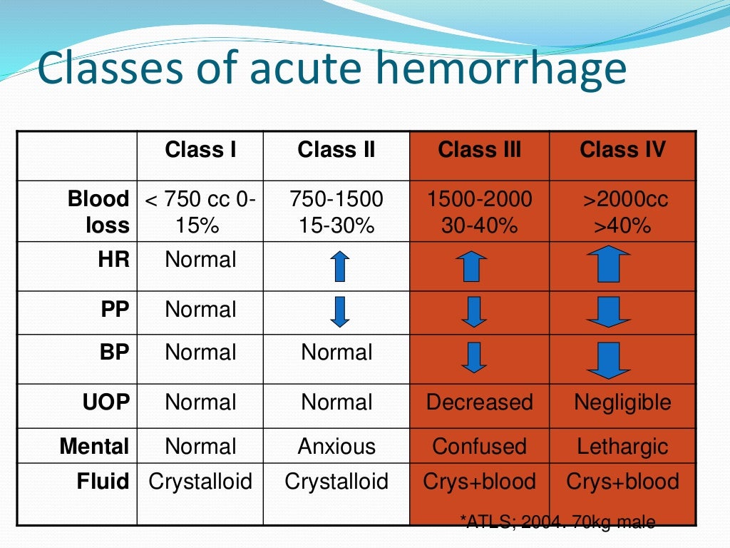 Classification of shock