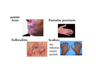Infectious Pustular Rash Classification of skin lesions pdf | PDF
