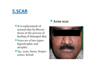 Scar Shape Classification Classification of skin lesions pdf | PDF