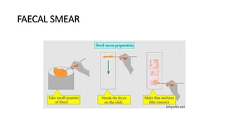 Smear Making Comprehensive Overview of Staining Methods and Smear Preparation in ...