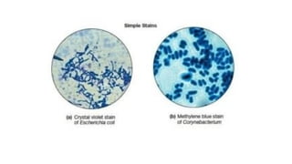 Smear Method Comprehensive Overview of Staining Methods and Smear Preparation in ...