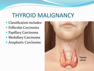 Classification of Thyroid Diseases