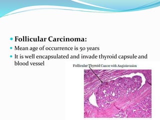 Classification of Thyroid Diseases