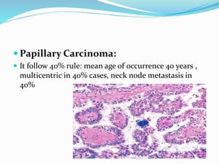 Classification of Thyroid Diseases