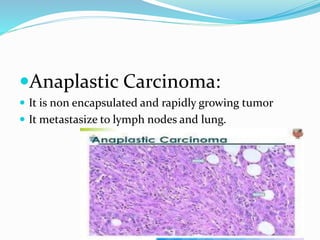 Classification of Thyroid Diseases