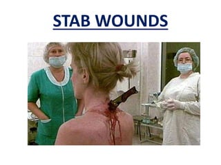 STAB WOUNDS
 