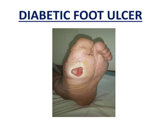 DIABETIC FOOT ULCER
 