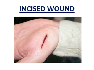 INCISED WOUND
 