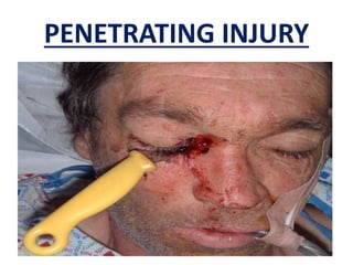 PENETRATING INJURY
 
