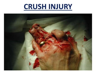 CRUSH INJURY
 