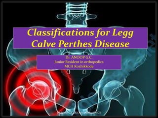 Dr. ANOOP G.C.
Junior Resident in orthopedics
MCH Kozhikkode
Classifications for Legg
Calve Perthes Disease
Dr.Anoop G.C.,JR,Orthopaedics,GMCK
 
