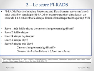 3 – Le score PI-RADS
• PI-RADS: Prostate Imaging Reporting and Data System: score similaire à
celui utilisé en sénologie (BI-RADS en mammographie) dans lequel un
score de 1 à 5 est attribué à chaque lésion selon chaque technique mp-MRI
:
-

Score 1: très faible risque de cancer cliniquement significatif
Score 2: faible risque
Score 3: risque équivoque
Score 4: risque élevé
Score 5: risque très élevé
Cancer cliniquement significatif =
Gleason ≥4+3 et/ou lésions ≥ 0,5cm3 en volume
ESUR prostate MR guidelines 2012 Jelle O. Barentsz , Jonathan Richenberg , Richard Clements , Peter Choyke , Sadhna Verma , Geert Villeirs , Olivier
Rouviere , Vibeke Logager , Jurgen J. Fütterer Eur Radiol (2012) 22:746–757

JFR 2013

10/15/2013

20

 